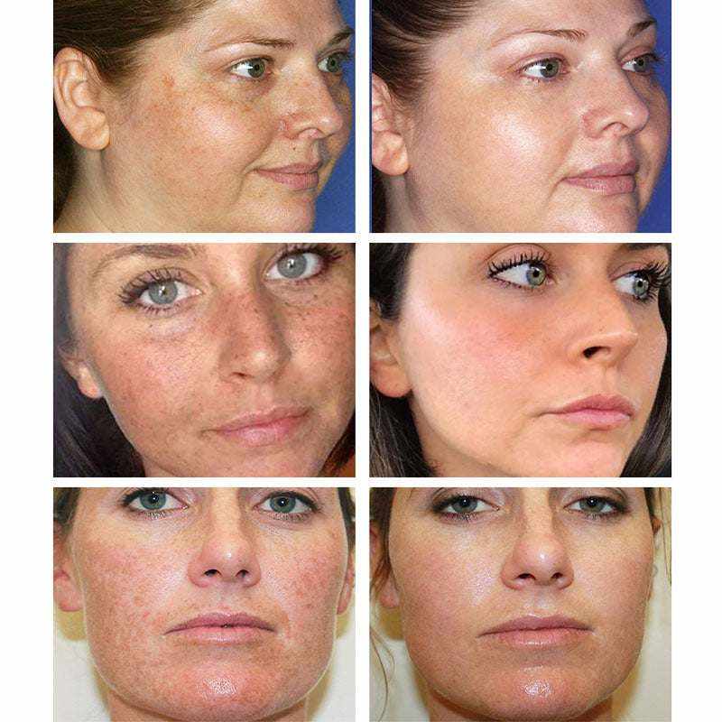 Moisturizing Cream Pore Shrinking Cream - ZYRALUX